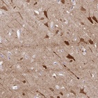 Anti-OR4N4 Antibody