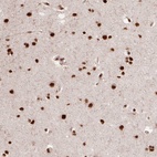 Anti-PPIG Antibody