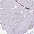 Immunohistochemical staining of human skeletal muscle shows no positivity in myocytes as expected.