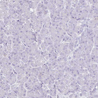 Anti-BEST1 Antibody