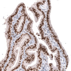 Immunohistochemical staining of human fallopian tube shows strong nuclear positivity in glandular cells.