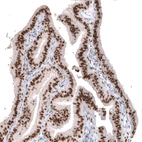 Immunohistochemical staining of human fallopian tube shows strong nuclear positivity in glandular cells.