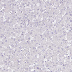 Immunohistochemical staining of human liver shows no positivity in hepatocytes as expected.