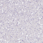 Anti-BEST1 Antibody