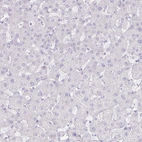 Immunohistochemical staining of human liver shows no positivity in hepatocytes as expected.