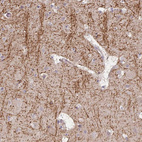 Anti-TSPAN31 Antibody