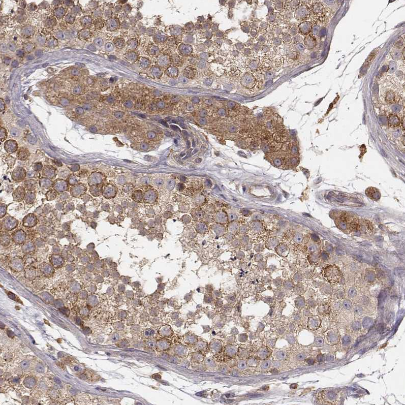 Anti-VPS26A Antibody