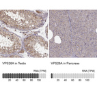 Anti-VPS26A Antibody