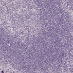 Immunohistochemical staining of human tonsil shows no positivity in lymphoid cells as expected.