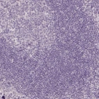 Immunohistochemical staining of human tonsil shows no positivity in lymphoid cells as expected.