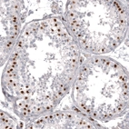 Immunohistochemical staining of human testis shows strong nuclear positivity in cells in seminiferous ducts.