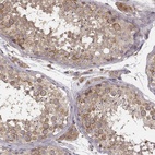 Immunohistochemical staining of human testis shows high expression.