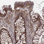 Immunohistochemical staining of human rectum shows moderate cytoplasmic positivity in glandular cells and subset of lymphoid cells.
