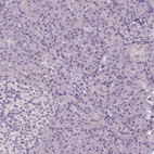 Anti-ANO2 Antibody