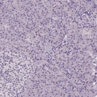 Immunohistochemical staining of human pancreas shows no positivity in either endocrine or exocrine glandular cells as expected.