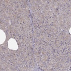 Immunohistochemical staining of human pancreas shows low expression as expected.