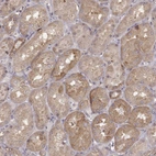 Immunohistochemical staining of human kidney shows moderate cytoplasmic positivity in cells in tubules.