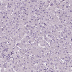 Anti-ANO2 Antibody