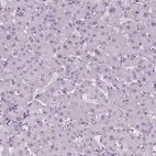 Immunohistochemical staining of human liver shows no positivity in hepatocytes as expected.