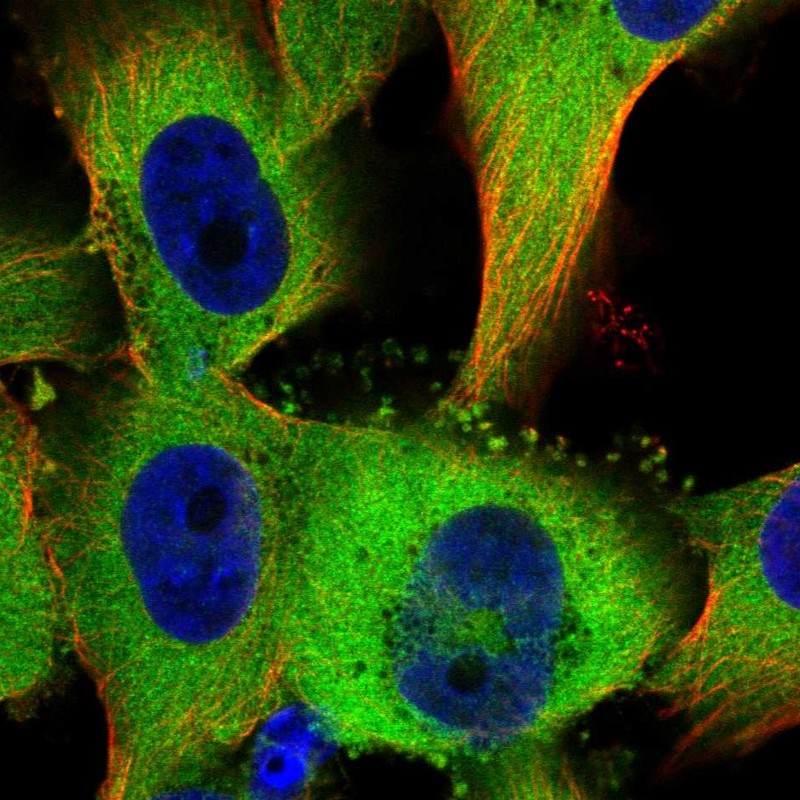 Anti-TTC1 Antibody