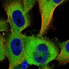 Anti-TTC1 Antibody
