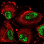 Immunofluorescent staining of human cell line U-251 MG shows localization to nuclear speckles.