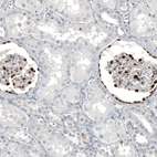 Immunohistochemical staining of human kidney shows strong nuclear positivity in cells in glomeruli.