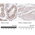 Anti-PIWIL4 Antibody