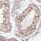 Immunohistochemical staining of human testis shows strong nuclear positivity in cells in seminiferous ducts.