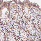 Anti-PIWIL4 Antibody