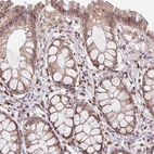 Immunohistochemical staining of human rectum shows moderate nuclear positivity in lymphoid cells.