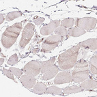 Anti-PIWIL4 Antibody