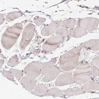 Immunohistochemical staining of human skeletal muscle shows no positivity in myocytes as expected.