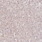 Immunohistochemical staining of human liver shows low positivity in hepatocytes as expected.