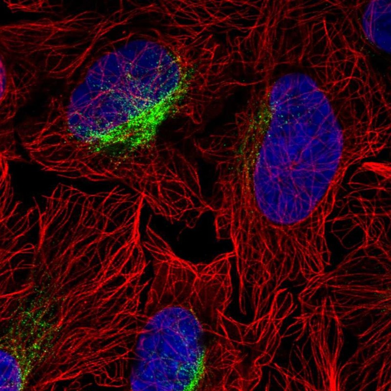 Anti-ZCCHC9 Antibody