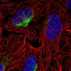Anti-ZCCHC9 Antibody