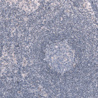 Immunohistochemical staining of human lymph node shows no positivity in germinal center cells as expected.