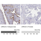 Anti-LRRC23 Antibody