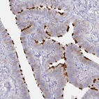 Anti-LRRC23 Antibody