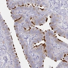 Immunohistochemical staining of human fallopian tube shows high expression.