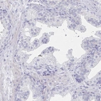 Immunohistochemical staining of human prostate shows low expression as expected.