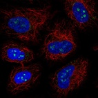 Anti-LRRC23 Antibody