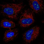 Immunofluorescent staining of human cell line A549 shows localization to nucleoli.