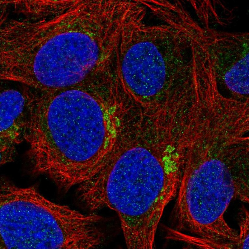 Anti-ZFAND4 Antibody