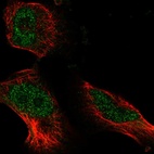 Anti-ATE1 Antibody