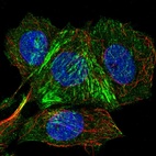 Anti-IFT46 Antibody