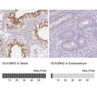 Anti-SUV39H2 Antibody