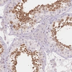 Immunohistochemical staining of human testis shows high expression.