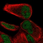 Anti-NHLRC2 Antibody