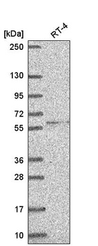 Anti-RRP8 Antibody